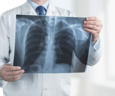 Incredible Results with the O2LungTrainer!